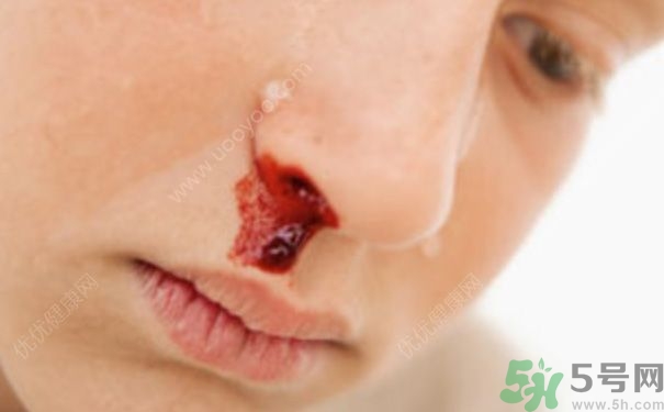 15歲男孩可以刮胡子嗎？15歲男孩經(jīng)常流鼻血怎么回事？