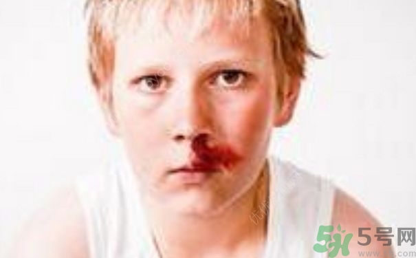 15歲男孩可以刮胡子嗎？15歲男孩經(jīng)常流鼻血怎么回事？