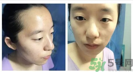 奧倫納素黑皂好用嘛?奧倫納素黑皂測評 奧倫納素黑皂好用嘛?奧倫納素黑皂測評