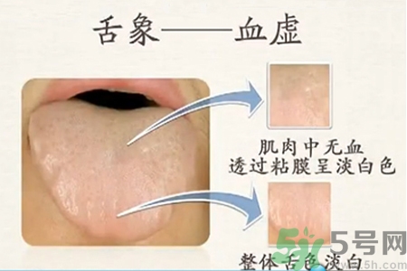 血虛的癥狀是什么？血虛的表現(xiàn)有哪些？