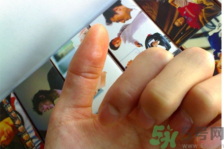 腳上長(zhǎng)雞眼是怎么回事？腳上長(zhǎng)雞眼是怎么辦？