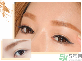 切眉后多久恢復(fù)自然？切眉術(shù)后面部淤青多久才能消？