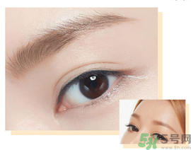 切眉后多久恢復(fù)自然？切眉術(shù)后面部淤青多久才能消？