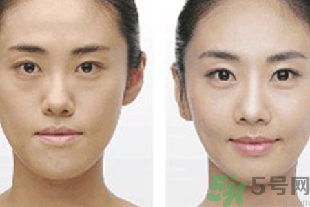 激光縮毛孔多少錢一次？激光縮毛孔一個療程多少錢？