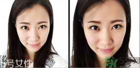 切眉是什么意思？切眉是怎么回事？