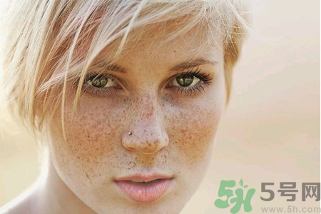 臉上長雀斑吃什么好？有雀斑不能吃什么？