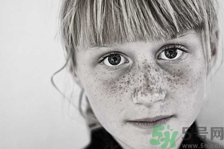 臉上長雀斑吃什么好？有雀斑不能吃什么？