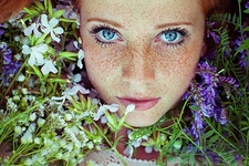 臉上長雀斑吃什么好？有雀斑不能吃什么？