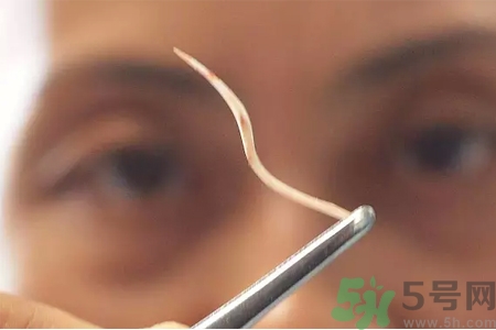 如何避免魚刺卡喉嚨？魚刺卡喉嚨如何處理？