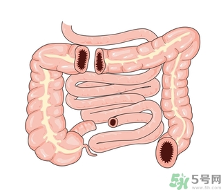 腸炎肚子疼怎么辦？腸炎肚子疼怎么緩解？