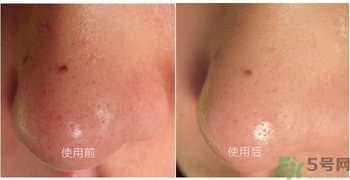 white蘆薈膠鼻貼多少錢(qián)?white蘆薈膠鼻貼專柜價(jià)格