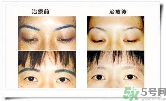 紋眉毛有什么危害？紋眉后注意事項