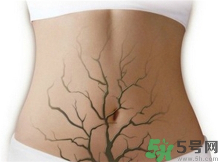 白帶發(fā)黃是什么原因?白帶發(fā)黃有異味怎么治? 白帶發(fā)黃是什么原因?白帶發(fā)黃有異味怎么治?