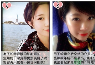 蛇毒眼膜孕婦可以用嗎？ 日本spa蛇毒眼膜孕婦能用嗎？