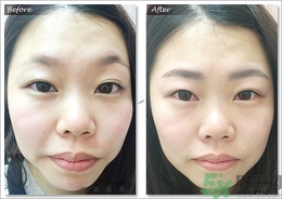 眉毛怎么整形好看？眉毛怎么整自然？