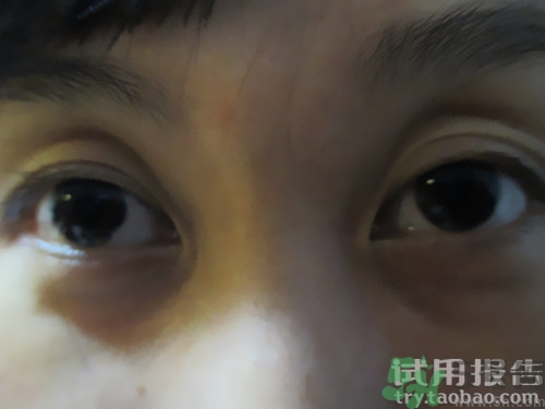 蛇毒眼膜效果怎么樣？spa蛇毒眼膜紅色好用嗎？