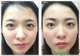 眉毛怎么整形好看？眉毛怎么整自然？