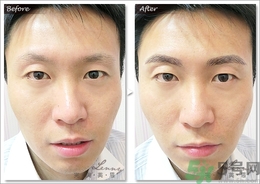 眉毛怎么整形好看？眉毛怎么整自然？