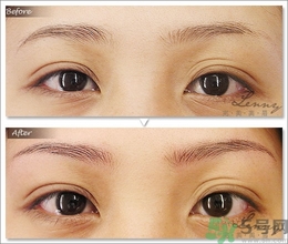 眉毛怎么整形好看？眉毛怎么整自然？