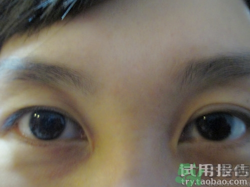 蛇毒眼膜效果怎么樣？spa蛇毒眼膜紅色好用嗎？