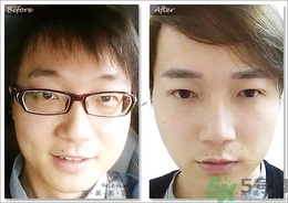 眉毛怎么整形好看？眉毛怎么整自然？