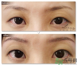 眉毛怎么整形好看？眉毛怎么整自然？