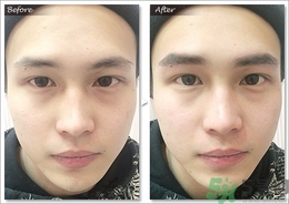 眉毛怎么整形好看？眉毛怎么整自然？