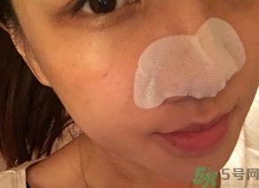 麗得姿鼻貼三部曲怎么樣?麗得姿鼻貼三部曲好用嗎? 麗得姿鼻貼三部曲怎么樣?麗得姿鼻貼三部曲好用嗎?