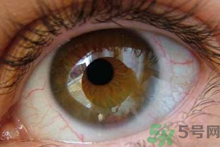 ?干眼癥的治療方法是什么？如何預防干眼癥？