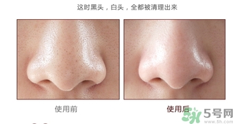 yu.r巧克力棒鼻貼怎么樣？yu.r巧克力鼻貼好用嗎？