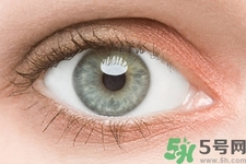 黑眼圈是怎么形成的？黑眼圈是什么原因引起的？