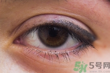 眼睛疼是怎么回事?眼睛疼怎么緩解妙招 眼睛疼是怎么回事?眼睛疼怎么緩解妙招