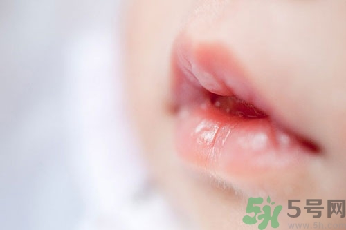 寶寶嘴巴干怎么回事?寶寶嘴巴干起皮怎么辦 寶寶嘴巴干怎么回事?寶寶嘴巴干起皮怎么辦