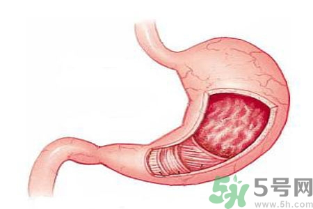 緩解胃脹的方法是什么？胃脹可以吃什么？