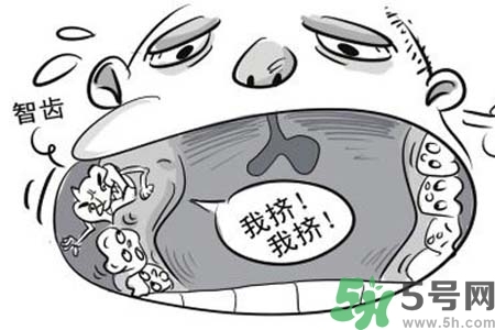 智齒橫著長(zhǎng)怎么辦？智齒橫著長(zhǎng)一定要拔了嗎？