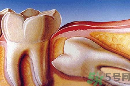 拔智齒一顆多少錢？拔除智齒收費(fèi)多少？