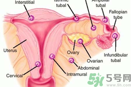 宮外孕手術(shù)后吃什么好？宮外孕手術(shù)后需要注意什么？