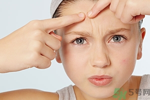 什么樣的痘痘能擠？哪些痘痘不能擠？