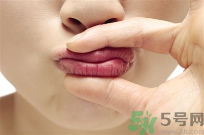 孕婦嘴唇干裂脫皮怎么回事？孕婦嘴唇干裂脫皮是缺什么