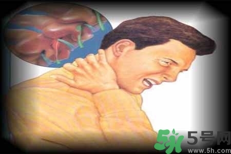 肩頸痛怎么回事？肩頸痛怎么辦？