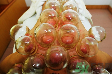 月經(jīng)可以拔火罐嗎？經(jīng)期可以拔火罐嗎？