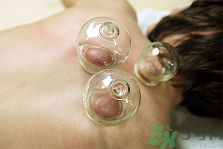 月經(jīng)可以拔火罐嗎？經(jīng)期可以拔火罐嗎？