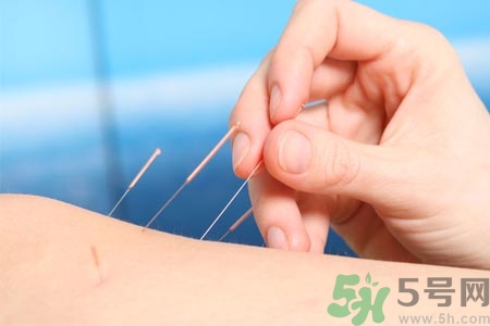 針灸一次要扎多長時間？針灸可以幾天做一次？