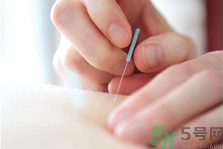 針灸一次要扎多長時間？針灸可以幾天做一次？