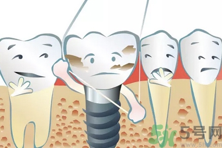 牙線對牙齒好嗎？牙線怎么正確使用？