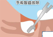 智齒拔完后有個(gè)洞怎么辦？拔智齒后有個(gè)洞多久能長(zhǎng)好？