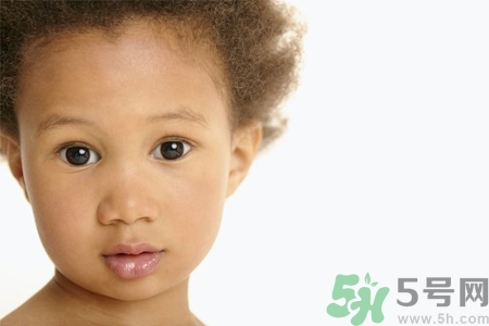 小孩皮膚黑怎么回事？小孩皮膚黑怎么變白？