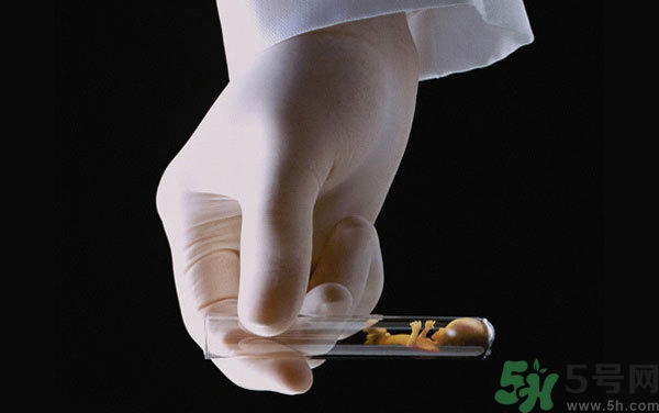 做試管嬰兒要多長時(shí)間？做試管嬰兒可以選擇性別？