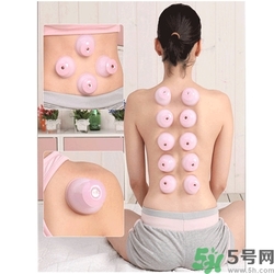 在家拔罐需要注意什么？在家拔罐幾天拔一次？