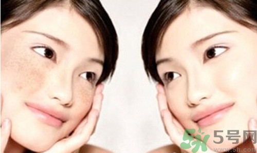 色斑分為哪幾種？有色斑該多吃什么好？